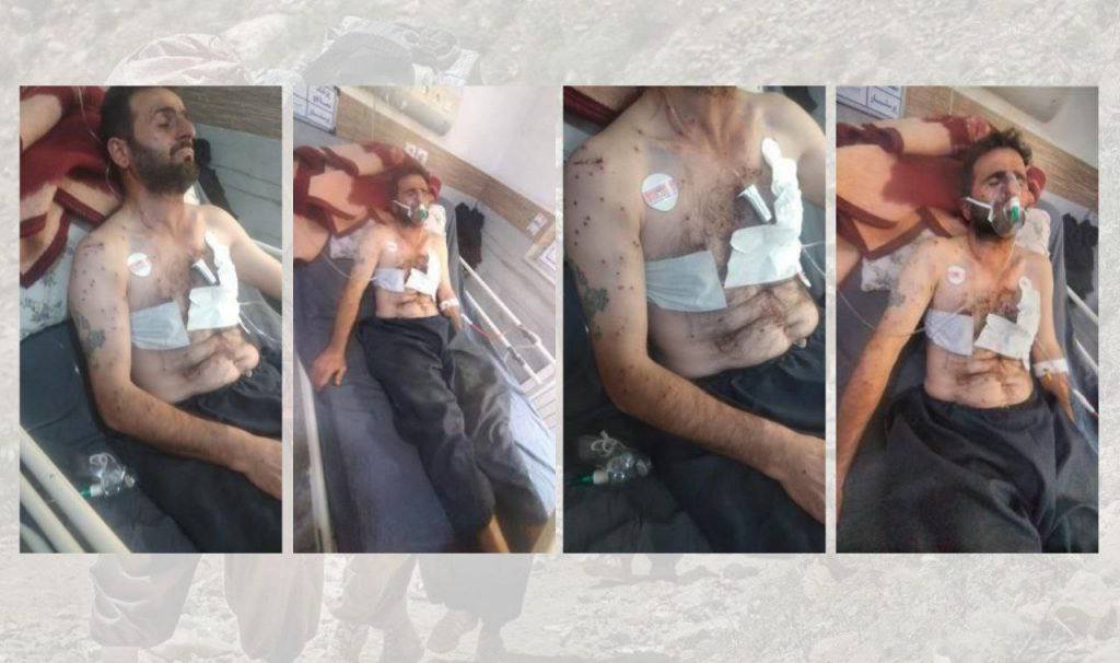 Injury of a Kolbar by direct shooting from border guards.