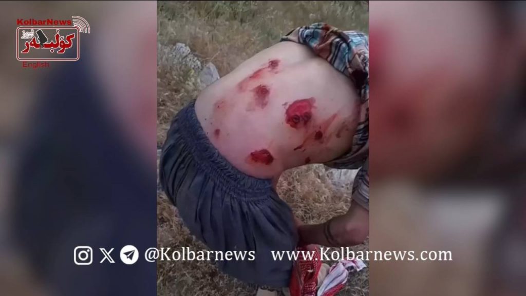 Nowsud: A Kolbar Injured by Direct Shooting of Border Forces
