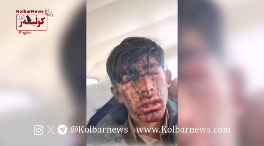 Sardasht; Injury of a child Kolbar by border guards