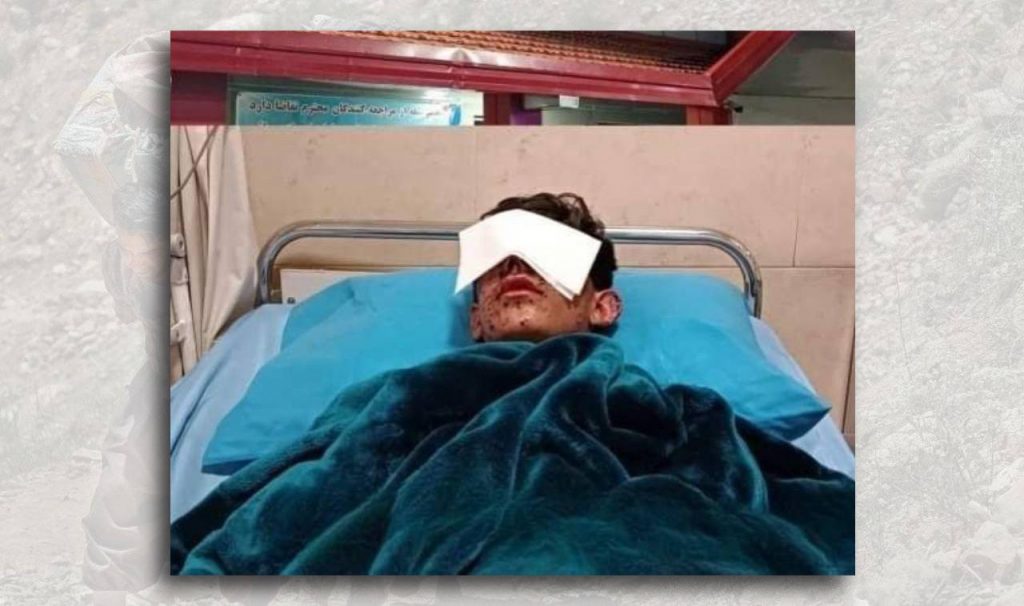 Blinding of one eye of “Aryan Memandi,” a child Kolbar from Sardasht