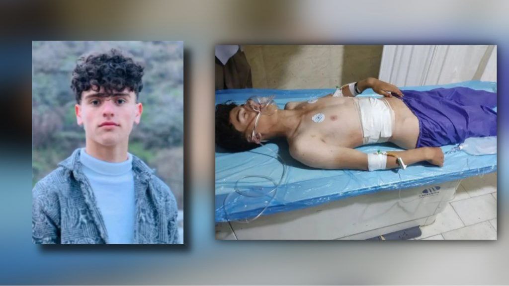 Sardasht: Injury of a 15-Year-Old Child Kolbar by Border Guards’ Direct Shooting