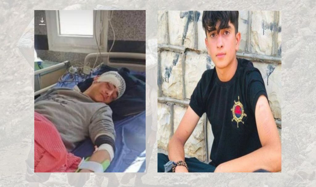 Nowsud: Sina Naderi, a Jina Movement Child Detainee, Injured for the Second Time