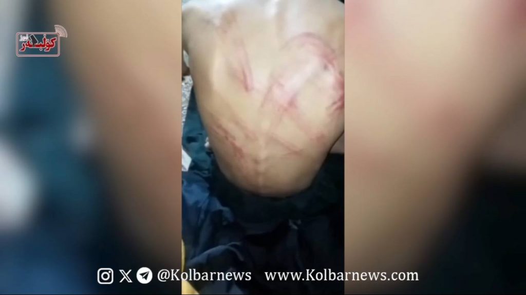 Saravan: Arrest and Beating of a Baloch Sukhtbar