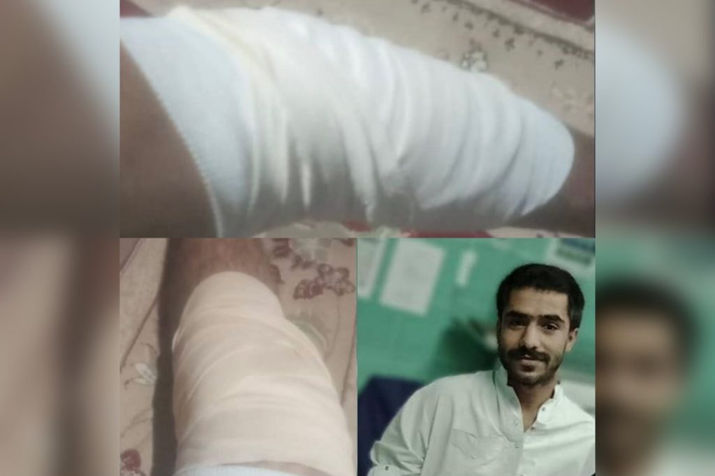 Hirmand: Injury of a Young Baloch by Military Forces