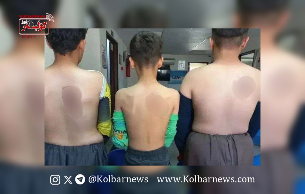 Marivan: Three Child Laborers Victims of Abuse by Employer