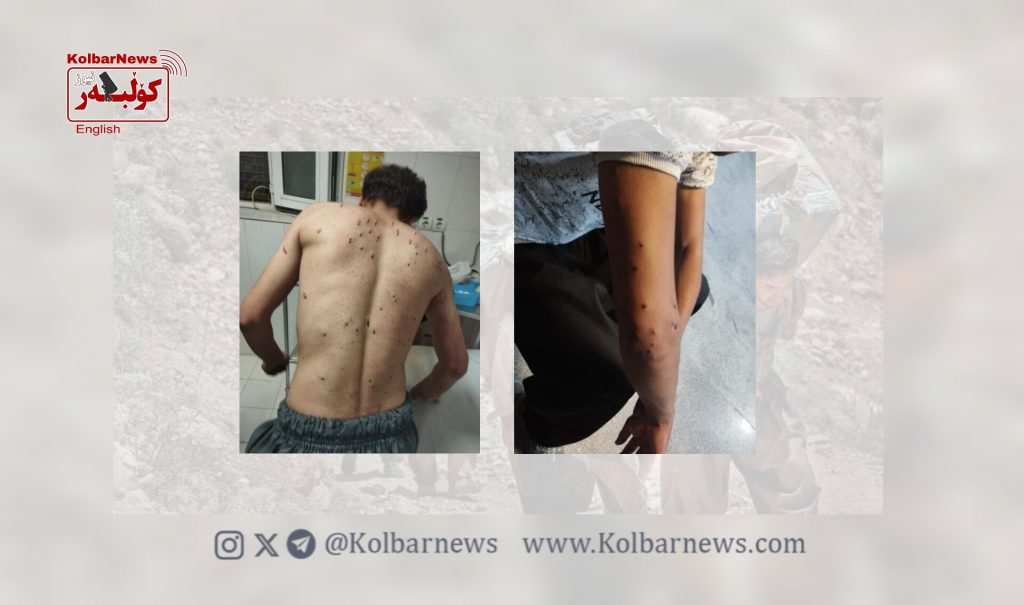 Nowsud: At Least Two Kolbars Injured by Border Regiment Forces