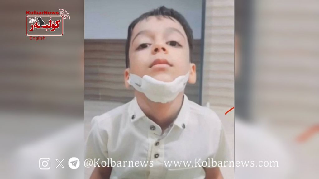 Kohnooj: Six-Year-Old Student Suffers Jaw Fracture Due to Corporal Punishment