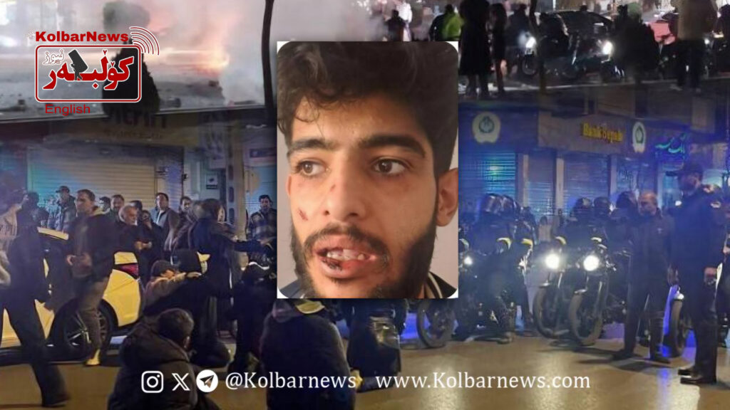 Ilam; Arrest of Meysam Nouri, one of the wounded patients, with broken wrists and teeth